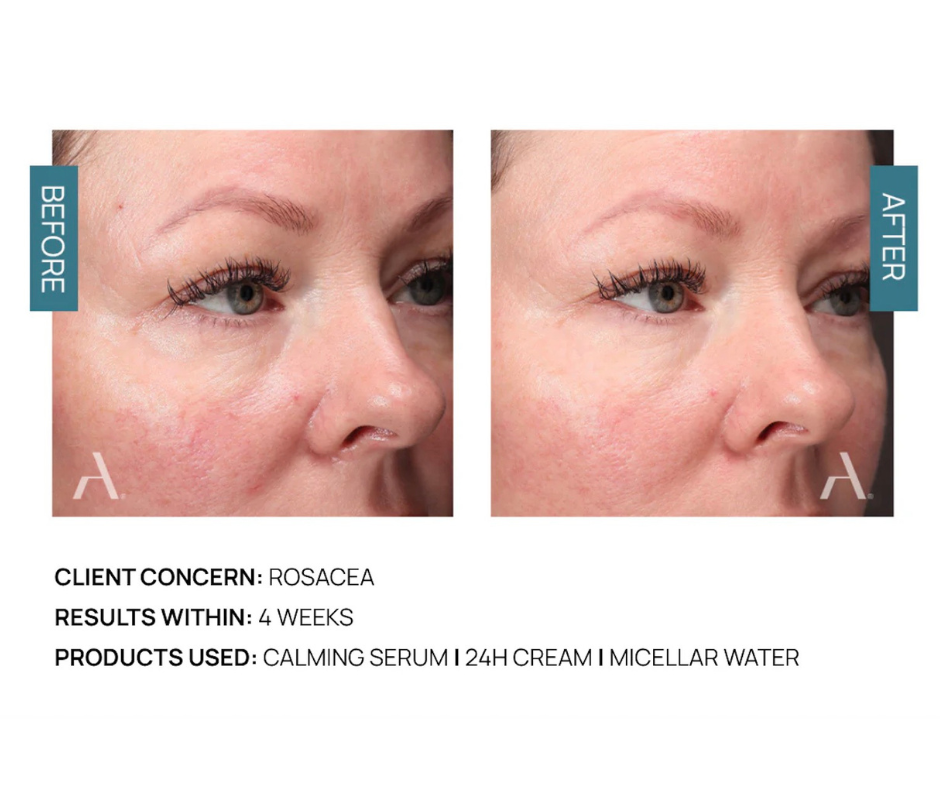 Calming serum AI skincare. 