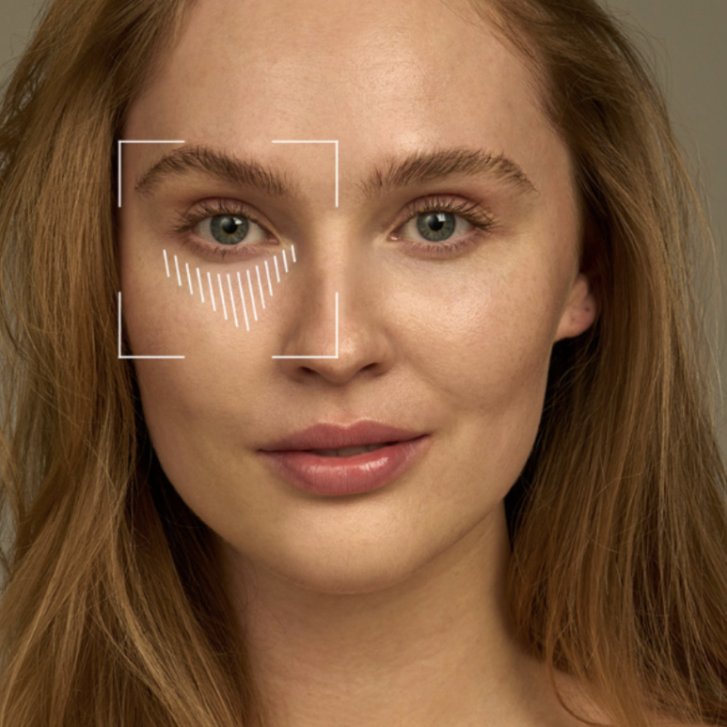 AI skincare